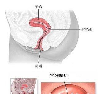 女性私处湿度看出排卵期