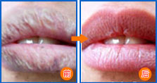 吃什么会导致嘴唇干裂 128252448.png