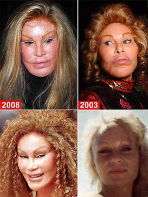 世界12大最可怕的整形失败案例