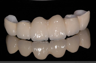 重庆哪里做烤瓷牙好?