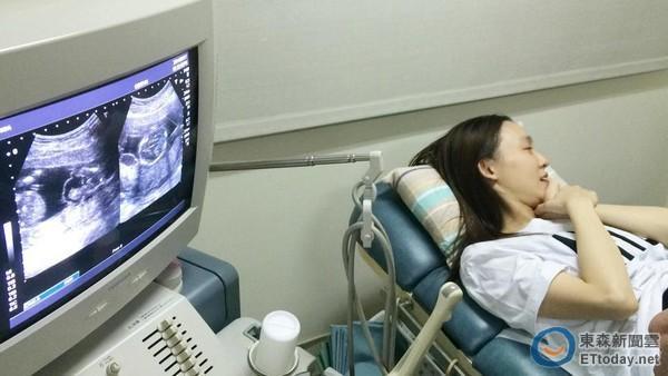 范玮琪大肚被指怀龙凤胎 黑人:平安健康就好