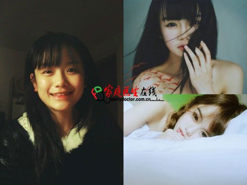 南笙妹妹惊悚旧照曝光被疑整容