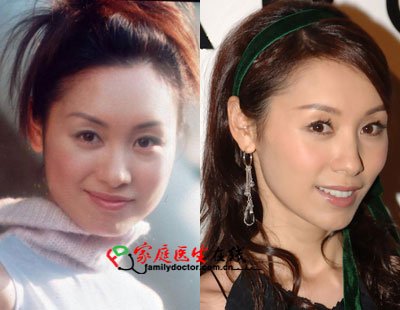 胡杏儿杨怡+细数tvb被传整容的女明星