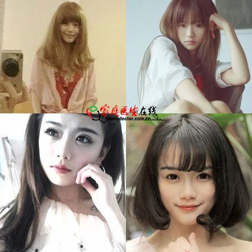 南笙妹妹惊悚旧照曝光被疑整容