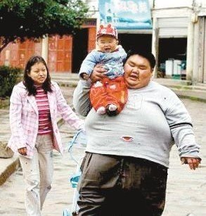 中国第一胖病重来渝就医(图)