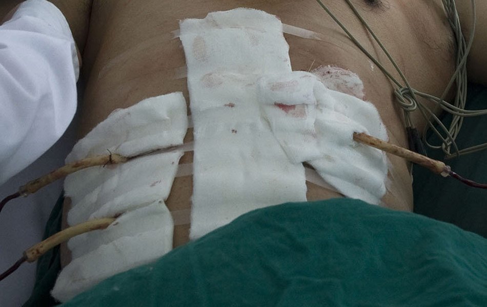 暗恋不成生恨 大叔捅死18岁<em>少女切腹</em>自尽|小说