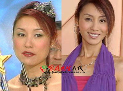 胡杏儿杨怡+细数tvb被传整容的女明星