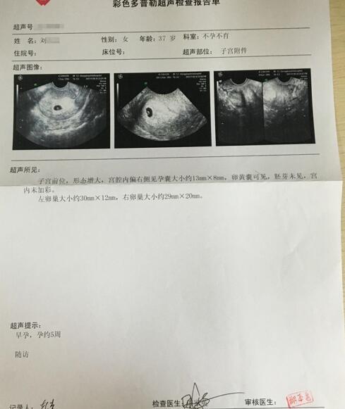 37岁女子4次宫外孕不放弃 治疗后走出噩梦