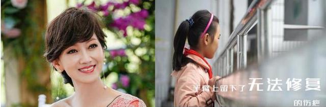 赵雅芝下月来渝看望合川疤痕女孩 邀爱心妈妈助力疤痕孩子