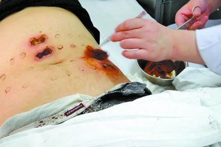 瘦身仪排行榜_艾媒金榜|2021年上半年中国美容仪品牌线上发展排行榜单TOP10