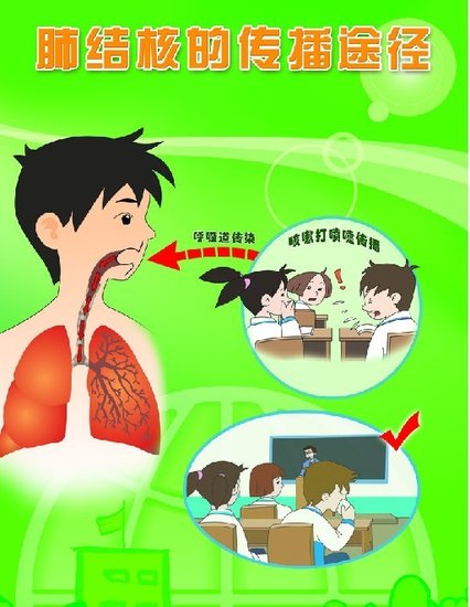 春季肺结核高发 预防7要素