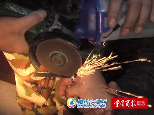 手指生冻疮肿胀 男子铂金戒指取不出(图)_大渝网_腾讯网