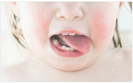 孩子咳嗽为什么吃药打针不见好?