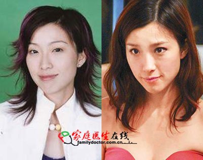 胡杏儿杨怡 细数TVB被传整容的女明星_大渝网_腾