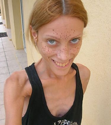 瘦就是美?厌食症干尸模特照片_大渝网_腾讯网