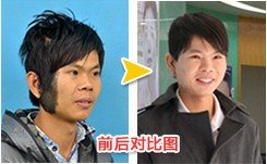 怎么才能快速去掉胎记 88958272.jpg