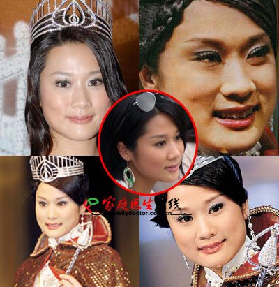 胡杏儿杨怡+细数tvb被传整容的女明星