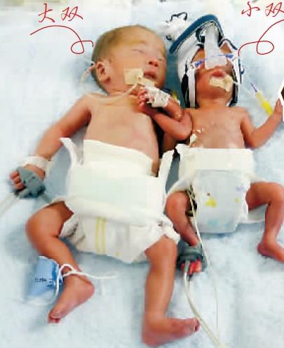 重庆体重最轻且成活的婴儿 出生时1斤3两!_大渝网_腾讯网