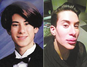 美国<em>小伙儿迷恋</em>整容整成芭比男友_大渝网_<em>腾讯网</em>