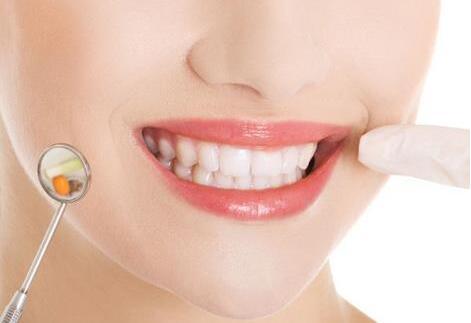 诚嘉口腔医生回答:牙齿缺失怎样修复才好