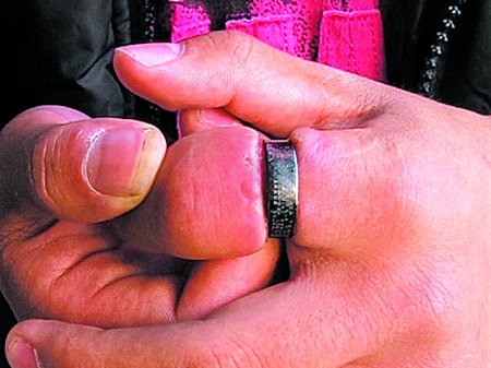 钢环卡住手指12天 消防官兵巧用电动砂轮切开