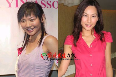 胡杏儿杨怡 细数TVB被传整容的女明星_大渝网_腾