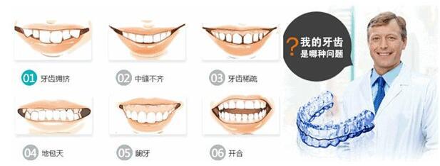 隐形矫正是什么怎么矫正牙齿?