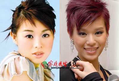 胡杏儿杨怡+细数tvb被传整容的女明星