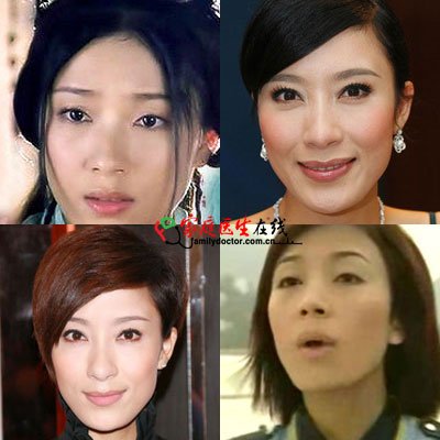 胡杏儿杨怡 细数TVB被传整容的女明星