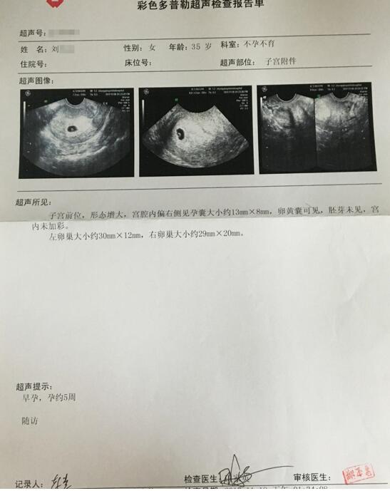 专家答疑:备孕二胎为何不孕?