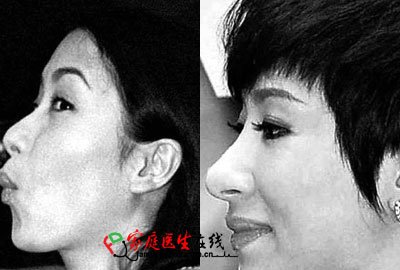 胡杏儿杨怡+细数tvb被传整容的女明星