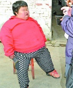 13岁女孩胖175斤 来渝求医不幸死在回家路上