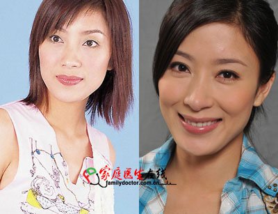胡杏儿杨怡+细数tvb被传整容的女明星