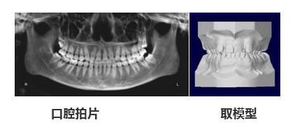 牙齿矫正反变龅牙妹 高三少女后悔莫及