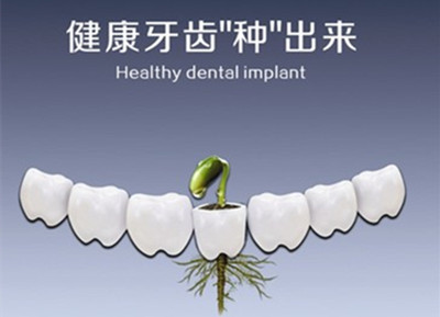 重庆正规口腔医院做种植牙多少钱