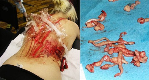 重口味慎入!全球误入歧途的整形达人