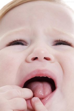 口腔溃疡是口腔黏膜疾病中的一种常见病症