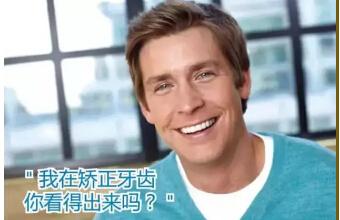 重庆牙博士口腔爱牙月之隐形矫正免费试戴专场