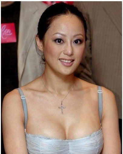 爆料:女明星隆胸隐私多多