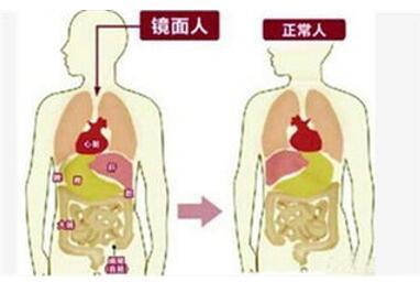 肾结石手术要做多少次 144522079.jpg