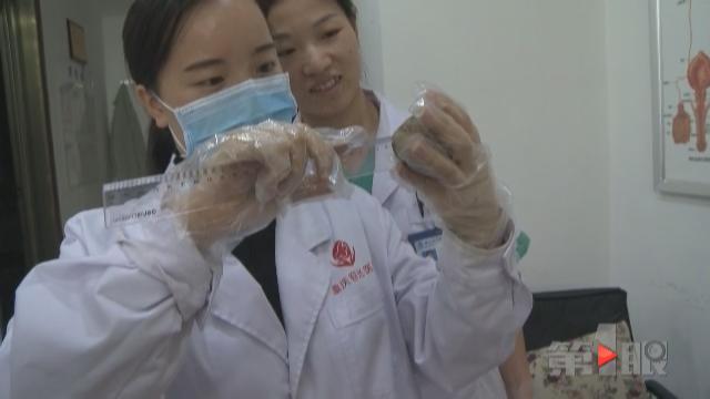 八旬大爷腹痛20年 肚里藏块“鹅卵石”