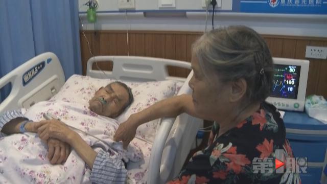 八旬大爷腹痛20年 肚里藏块“鹅卵石”