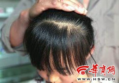 女生成绩下降遭老师揪<em>掉头发</em>_大渝网_腾讯网