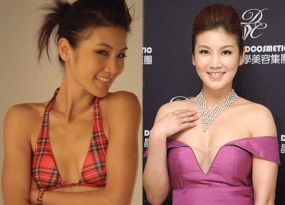 吴宗宪前女友坦言自己自体丰胸_大渝网_腾讯网