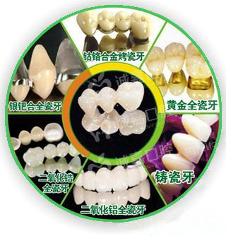 烤瓷牙的危害 诚嘉告诉您