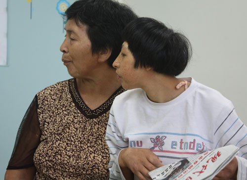 <em>20</em>岁<em>姐妹</em>头小如婴儿智力1岁半