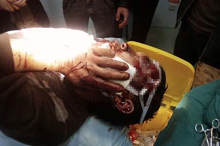 丈夫不洗脚引妻子嫌弃 两口子打架进医院