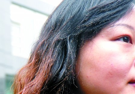 赠品打火机意外冒火球 女子面部灼伤获赔500元