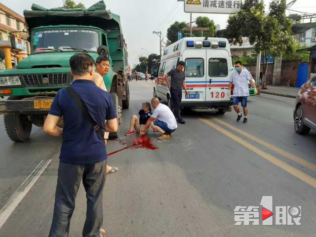 初一女生参加散学典礼 横穿公路被大货车压断腿