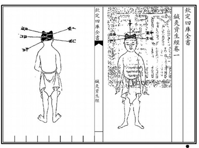 灸绝人口(2)